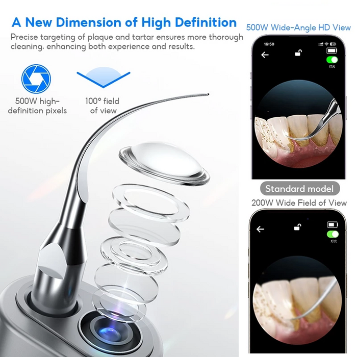 **Early Bird Exclusive Offer** Smiley - Ultrasonic Scaler with 360° Camera